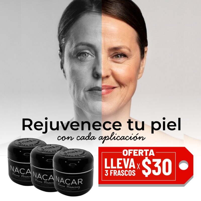 Imagen que muestra el antes y después de una mujer que usa crema rejuvenecedora Nacar, destacando la mejora en su piel. Se presentan tres frascos del producto con una oferta de $30. Texto promocional que invita a rejuvenecer la piel con cada aplicación.